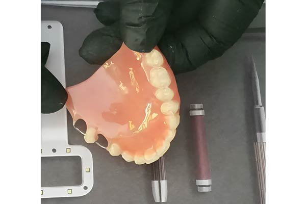 پروتز دندان در اسمایل استایل دنتیستری