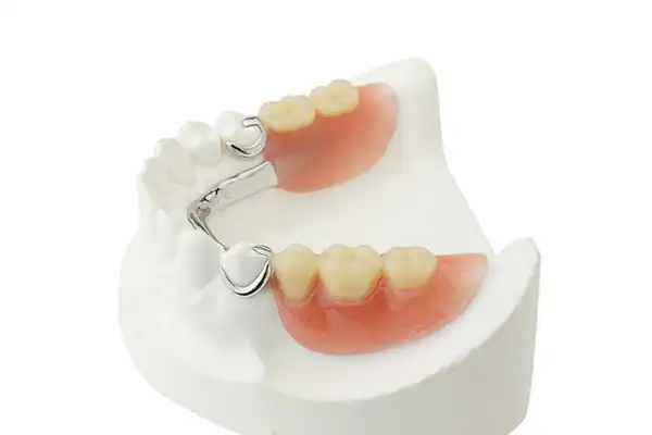 قیمت دندان مصنوعی برای افراد جوان